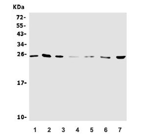 Neurotrophin 4 Antibody / NTF4