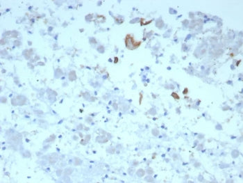 IHC staining of FFPE human adrenal gland tissue with IL-6 antibody (clone IL6/8713). HIER: boil tiss