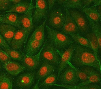 Immunofluorescent staining of FFPE human PC-3 cells with GNB1 antibody (red) and Alpha Tubulin mAb (