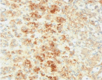 Adipophilin Antibody / Perilipin 2 / ADRP / PLIN2