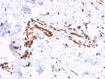 Collagen VII antibody / COL7A1