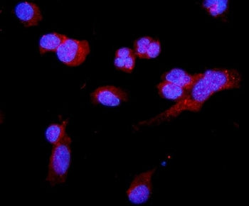 C5a-r Antibody / Complement C5A Receptor