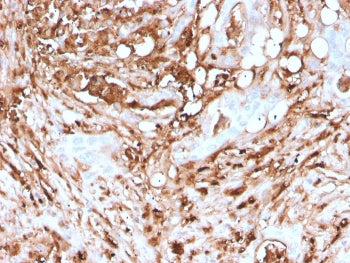 FTL Antibody / Ferritin light chain