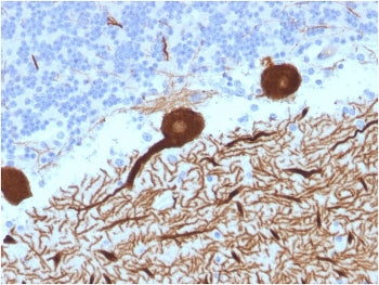 IHC testing of FFPE human cerebellum with CA8 antibody (clone CPTC-CA8-2). HIER: boil tissue section