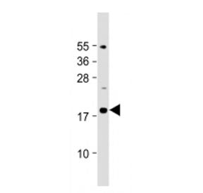 IL-23 Antibody (Center Region)