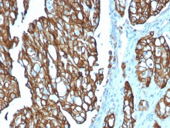 TROP2 Antibody