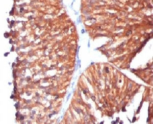 HSP60 Antibody