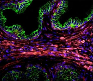 Cytokeratin-18 Antibody