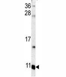 S100A6 Antibody