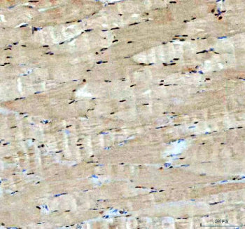 Immunohistochemical staining of FFPE human skeletal muscle tissue with ACSS2 antibody, HRP-secondary
