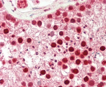 CDK14 Antibody