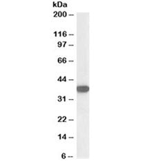 Western blot testing of Jurkat lysate with Nucleophosmin antibody at 0.1ug/ml. Expected/observed mol