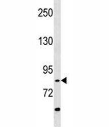 RIPK4 Antibody