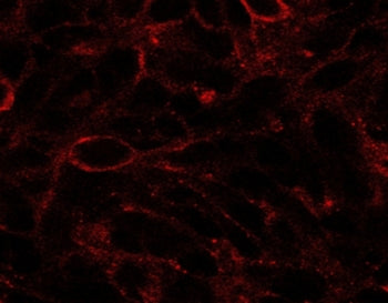 DISP1 Antibody