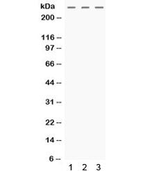 Western blot testing of human 1) HeLa, 2) MCF7 and 3) SW620 cell lysate with MGA antibody. Expected 