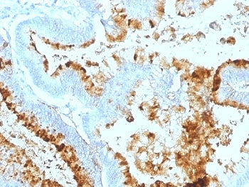 Blood Group Lewis a Antibody
