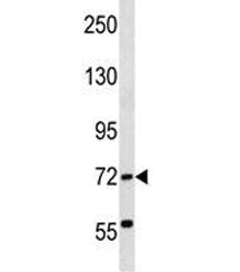 ABCF2 Antibody