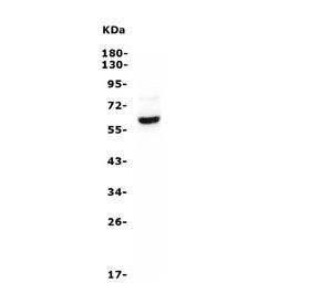 Western blot testing of human ThP-1 cell lysate with ASIC1 antibody. Predicted molecular weight ~60 