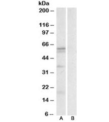 Western blot testing of human spleen lysate with LAT1 antibody at 0.3ug/ml with [B] and without [A] 