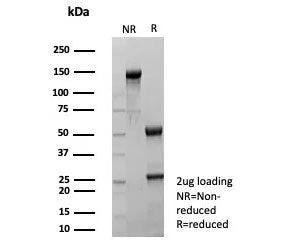 Estrogen Inducible Protein pS2 / TFF1 Antibody