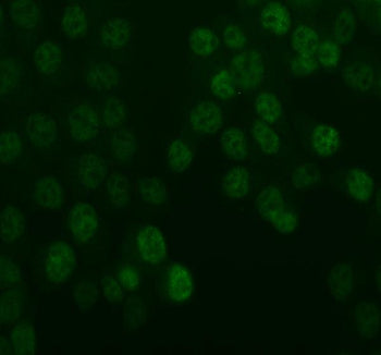 IF analysis of UBE2T using anti-UBE2T antibody (green). UBE2T was detected in an immunocytochemical 