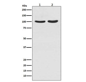 Androgen Receptor Antibody