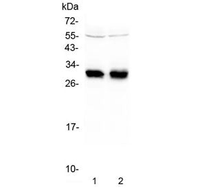 Western blot testing of two lots of human Raji lysate with HLA-DRB1 antibody at 0.5ug/ml. Predicted 