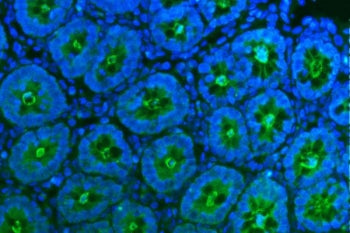 Tspan1 Antibody