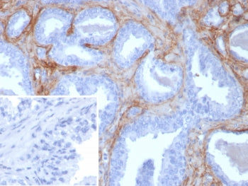 Periostin Antibody