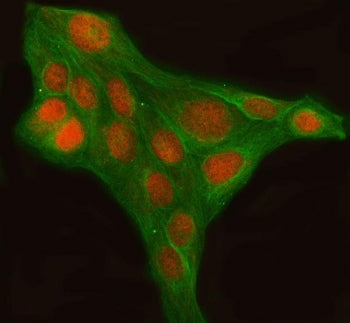 Immunofluorescent staining of FFPE human U-2 OS cells with LHX6 antibody (red) and Beta Tubulin mAb 