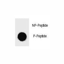 Dot blot analysis of phospho-BAD antibody. 50ng of phos-peptide or nonphos-peptide per dot were spot