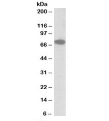 Western blot testing of human HepG2 lysate with IFNGR1 antibody at 0.3ug/ml. Predicted molecular wei