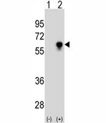 CDC25C Antibody