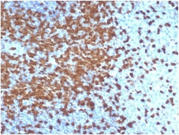 IHC staining of FFPE human tonsil tissue with recombinant ZAP70 antibody (clone ZAP70/6492R). HIER: 