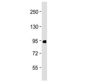 Western blot testing of human placenta lysate with Factor XIIIa antibody at 1:2000. Predicted molecu
