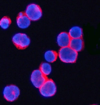 Immunofluorescent staining of FFPE human JK cells with CD3 gamma antibody (red) and DAPI nuclear sta