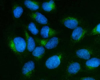 SCG10 Antibody / STMN2