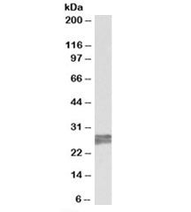 TNNI3 Antibody