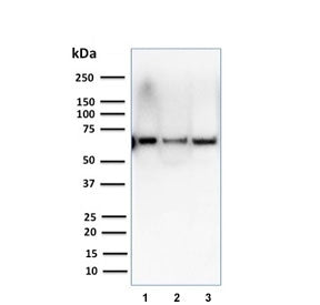 Western blot testing of human 1) T47-D, 2) SK-BR-3 and 3) A375 cell lysate using CSTF2T antibody (cl