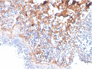 IHC staining of FFPE human tonsil with Fibronectin antibody (clone C6F10). HIER: boil tissue section