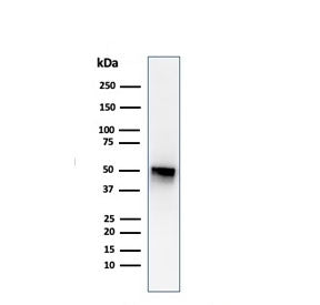 Western blot testing of human spleen lysate with Thymidine Phosphorylase antibody (clone P-GF.44C). 