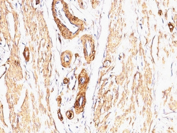 Alpha Actin Antibody / ACTA2 (smooth muscle)