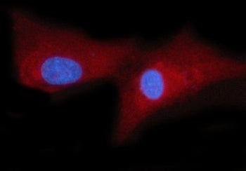 WRS Antibody / WARS1 / Tryptophanyl-tRNA synthetase
