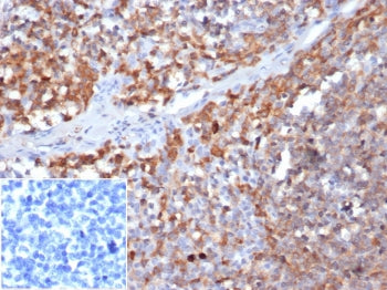 IHC staining of FFPE human tonsil tissue with Gamma Parvin antibody (clone 8C5.2) at 2ug/ml in PBS. 
