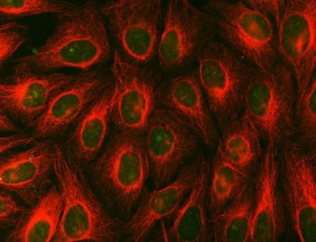 Immunofluorescent staining of FFPE human U-2 OS cells with SDCBP2 antibody (green) and Beta Tubulin 