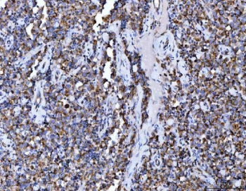 ACO2 Antibody / Aconitase 2