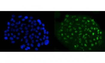 NFIB Antibody / Nuclear factor 1 B-type