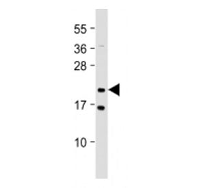 NRAS Antibody