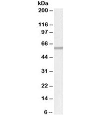 ATGL Antibody
