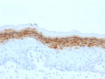 IHC testing of FFPE human skin with Filaggrin antibody (clone FLG/1561). Required HIER: boil tissue 